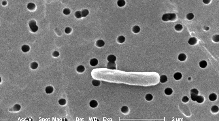 Araştırmacılar E.coli Bakterisinin Genlerini, Sentezlenen Genomla Değiştirdi 
