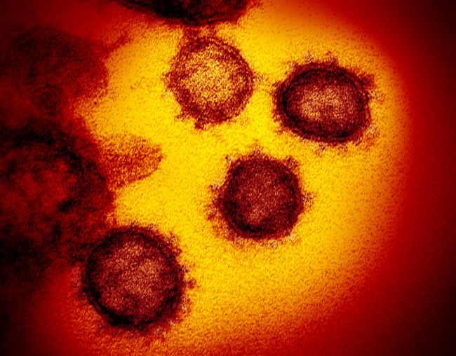 İşte Ortaya Yeni Çıkan Corona Virüs Görüntüleri 