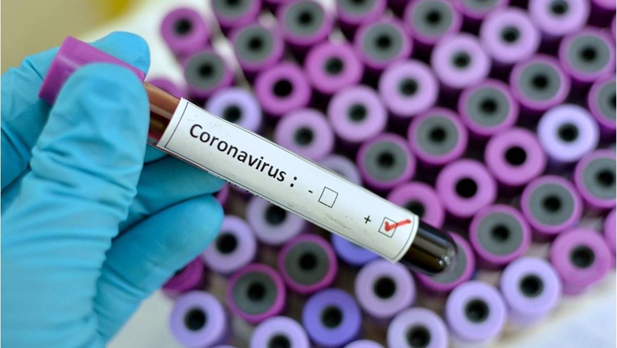 Yeni Geliştirilen Hızlı Koronavirüs Test Kiti Evde Anında Tanı Koyacak 