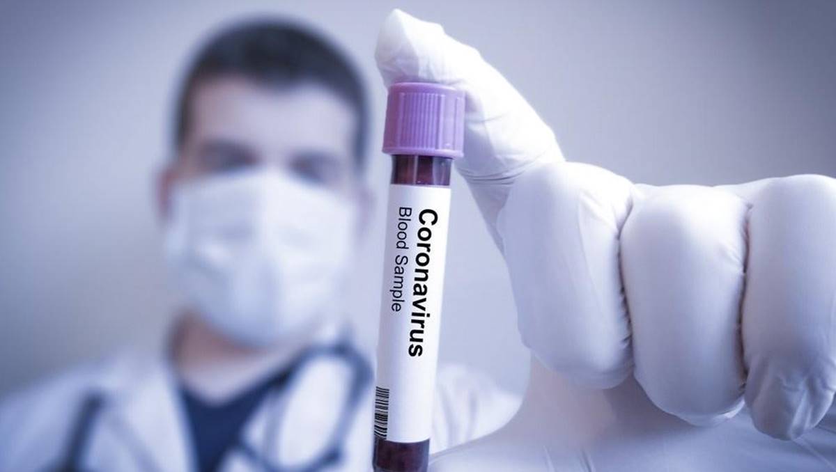 Koronavirüs İçin Yeni Bir Test Geliştirildi  