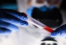 Rusya'nın Koronavirüs Aşısının İlk İki Aşamasının Sonuçları Yayınlandı 