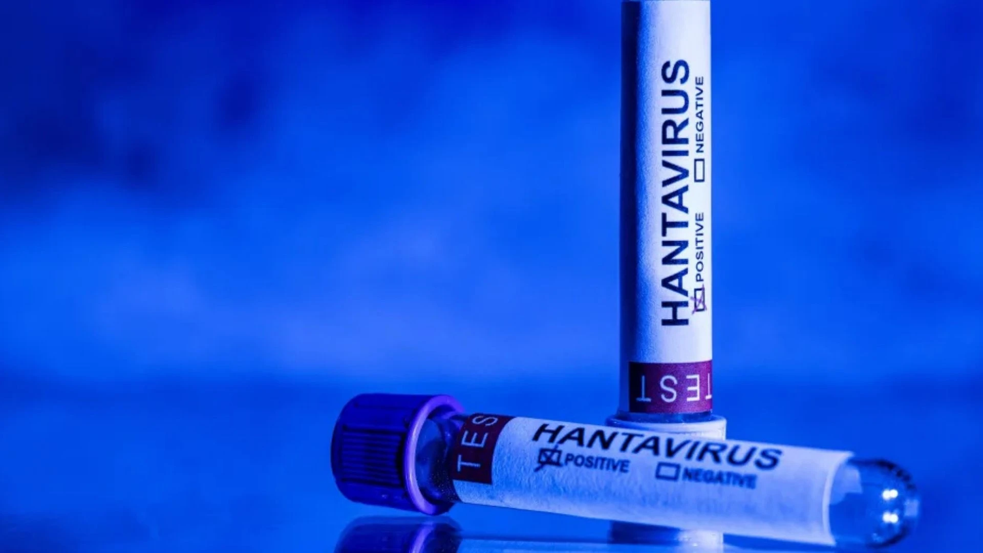 Hantavirüs Salgını: Grip Belirtileriyle Geliyor, Ancak Tehlikesi Büyük Hantavirüs Salgını: Grip Belirtileriyle Geliyor, Ancak Tehlikesi Büyük